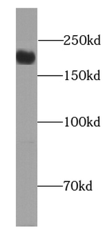 CLTCL1 Antibody