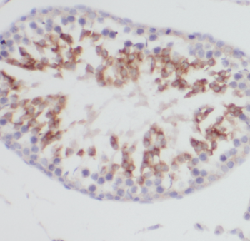 CLTCL1 Antibody