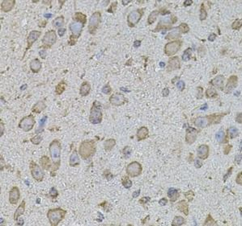 Collagen Type I Antibody