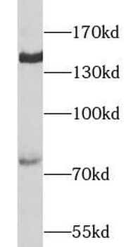 Collagen Type II Antibody