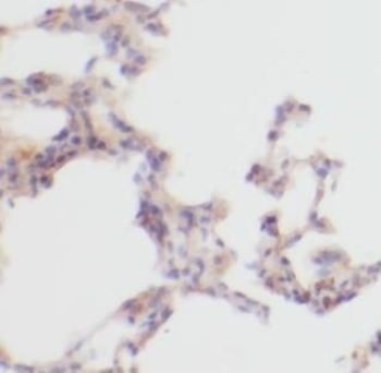 Collagen Type II Antibody