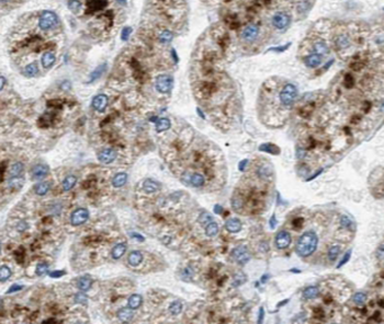 CFB Antibody