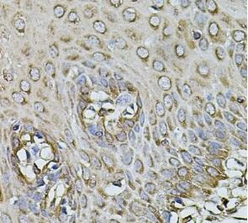 CPOX Antibody