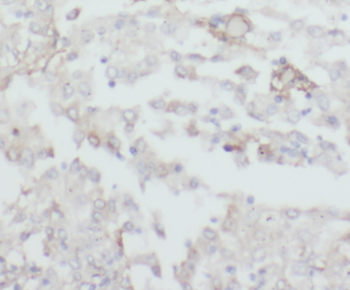 CPOX Antibody