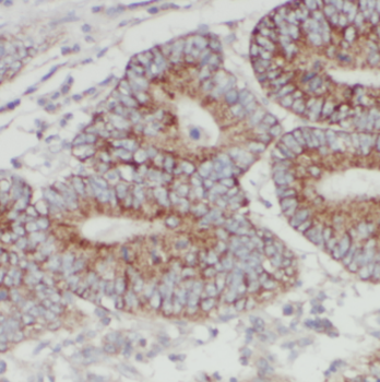 C1GALT1C1 Antibody