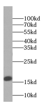 PPP1R14A Rabbit Polyclonal Antibody