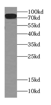 CPT1C Antibody