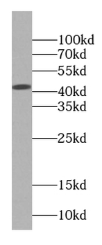 Creatine Kinase MM Antibody