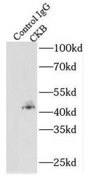 CKB Antibody