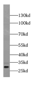 CRYBB1 Antibody