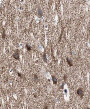 CRY2 Antibody