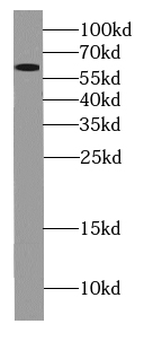 GPS1 Antibody