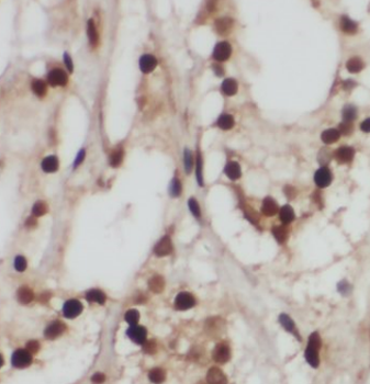 GPS1 Antibody