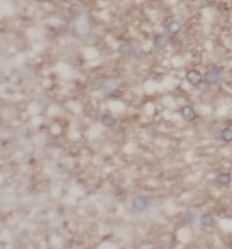 CX3CL1 Mouse Monoclonal Antibody