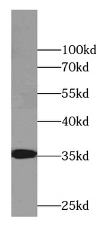 CYB5R3 Mouse Monoclonal Antibody