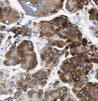 CYB5R3 Mouse Monoclonal Antibody