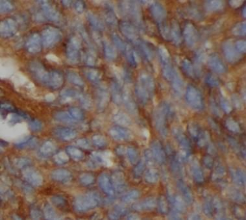 CYP2E1 Antibody