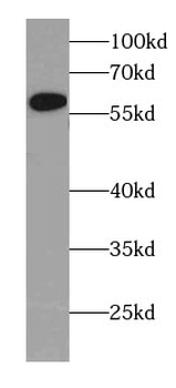 CYP4Z1 Antibody