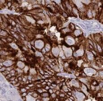 KRT13 Antibody