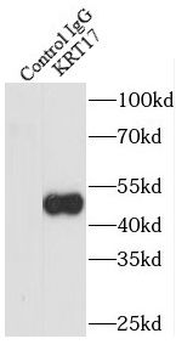 KRT17 Antibody