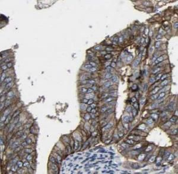 KRT7 Antibody