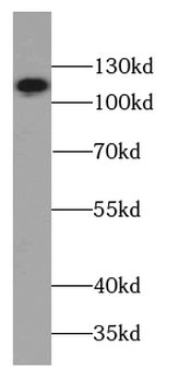 SPECC1 Rabbit Polyclonal Antibody