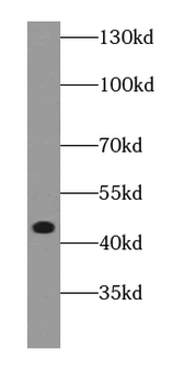 DAPK2 Antibody