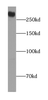 DSP Rabbit Polyclonal Antibody