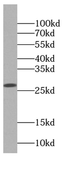 DGUOK Antibody