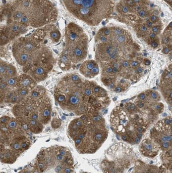 DGUOK Antibody
