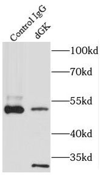 DGUOK Antibody