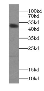 DCTN2 Mouse Monoclonal Antibody