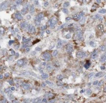 DCTN2 Mouse Monoclonal Antibody