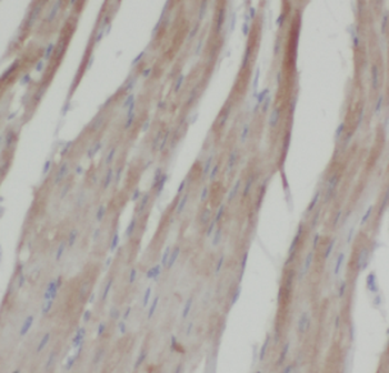 LPAR3 Antibody