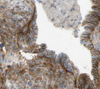 EEF1D Antibody