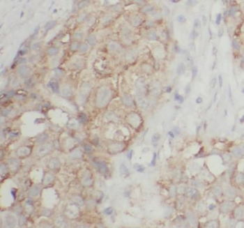 EGFR Antibody