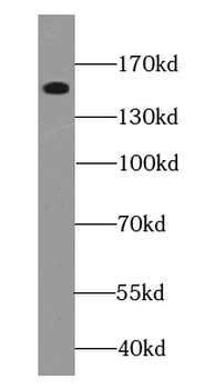EPHA1 Antibody