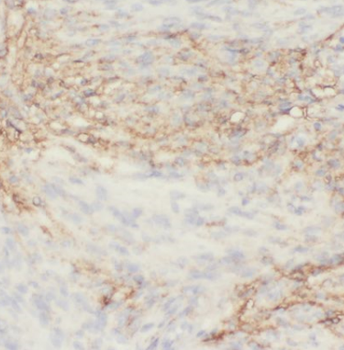 EPHA6 Antibody
