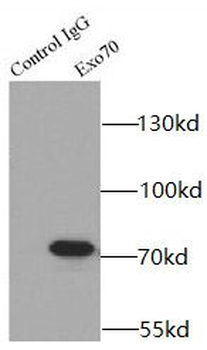 EXOC7 Antibody