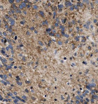 EXOC7 Antibody