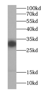 EXOSC2 Antibody