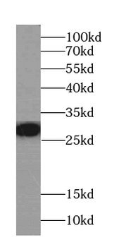 F12 Mouse Monoclonal Antibody