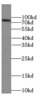 FAF1 Antibody