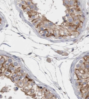 FAM8A1 Rabbit Polyclonal Antibody