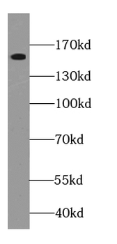FANCA Antibody