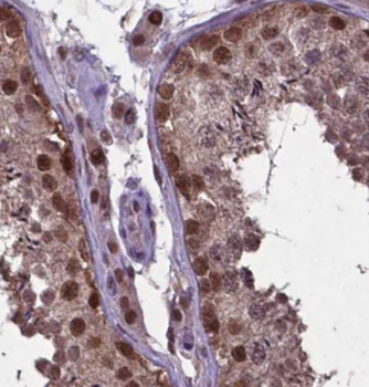 phospho-FANCD2 (S330) Antibody