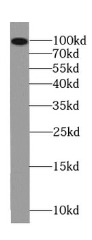 FBXO41 Antibody