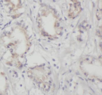 FCER1A Antibody