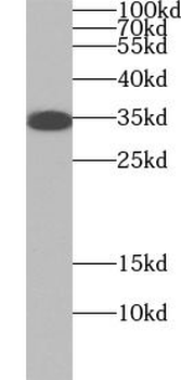 FCGRT Antibody