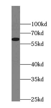 AHSG Antibody